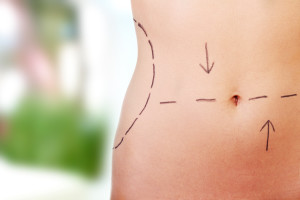 Cosmetic Surgery Boca Raton